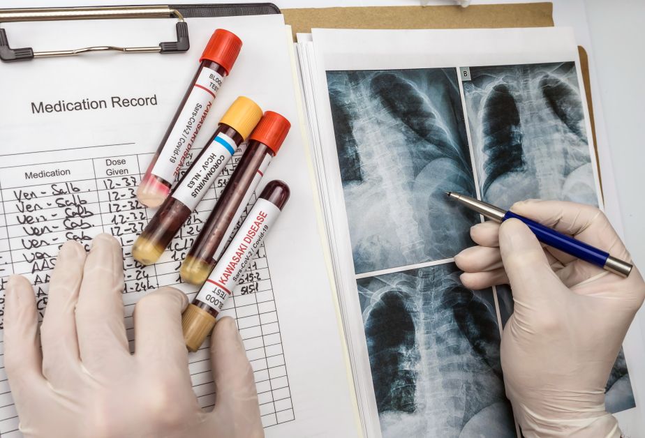 doctor-detects-diagnosis-in-a-child-s-lung