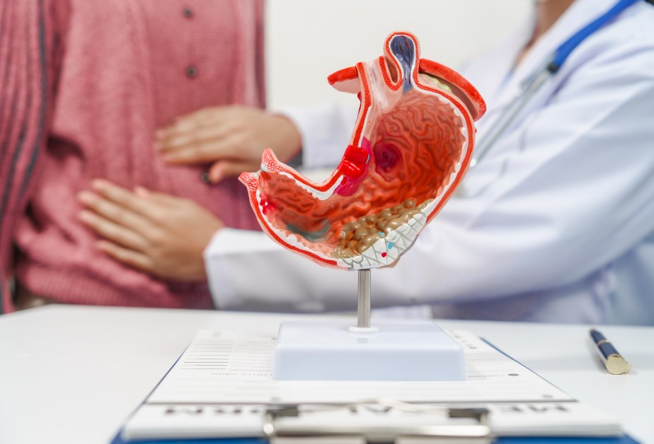 Анатомичен модел на човешки стомах, показващ структурата му, поставен на лекарско бюро пред пациент и лекар.