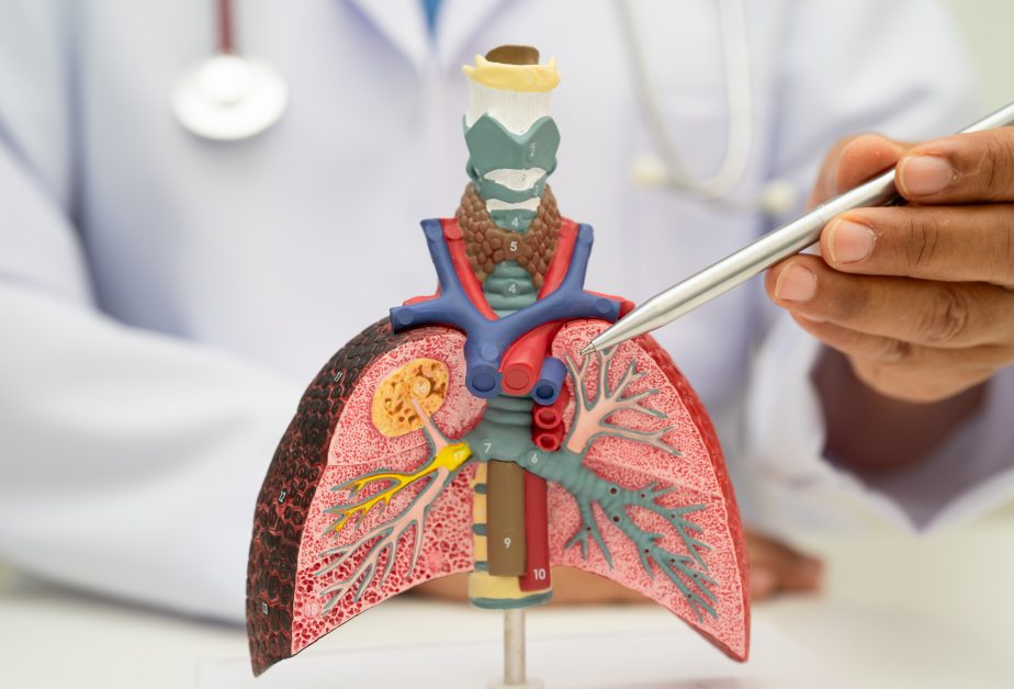 pneumonia-lung-cancer-asian-doctor-holding-model