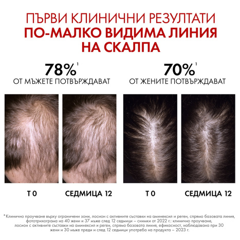 VICHY DERCOS AMINEXIL CLINICAL REGEN BOOSTER hair renewal serum 90ml