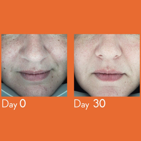 YOUTH LAB DARK SPOT REMOVER SERUM Серум против пигментация 30ml