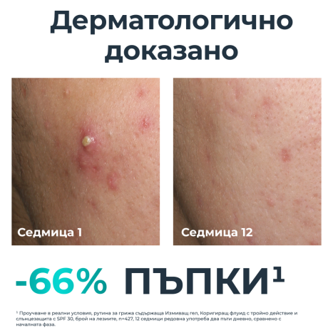 EUCERIN PROMO DERMOPURE CLINICAL Коригиращ флуид с тройно действие 40ml+ Eucerin Oil Control SPF50+ Слънцезащитен гел-крем за лице за мазна кожа 50ml