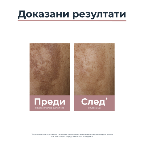 EUCERIN ANTI-PIGMENT day cream SPF30 50ml